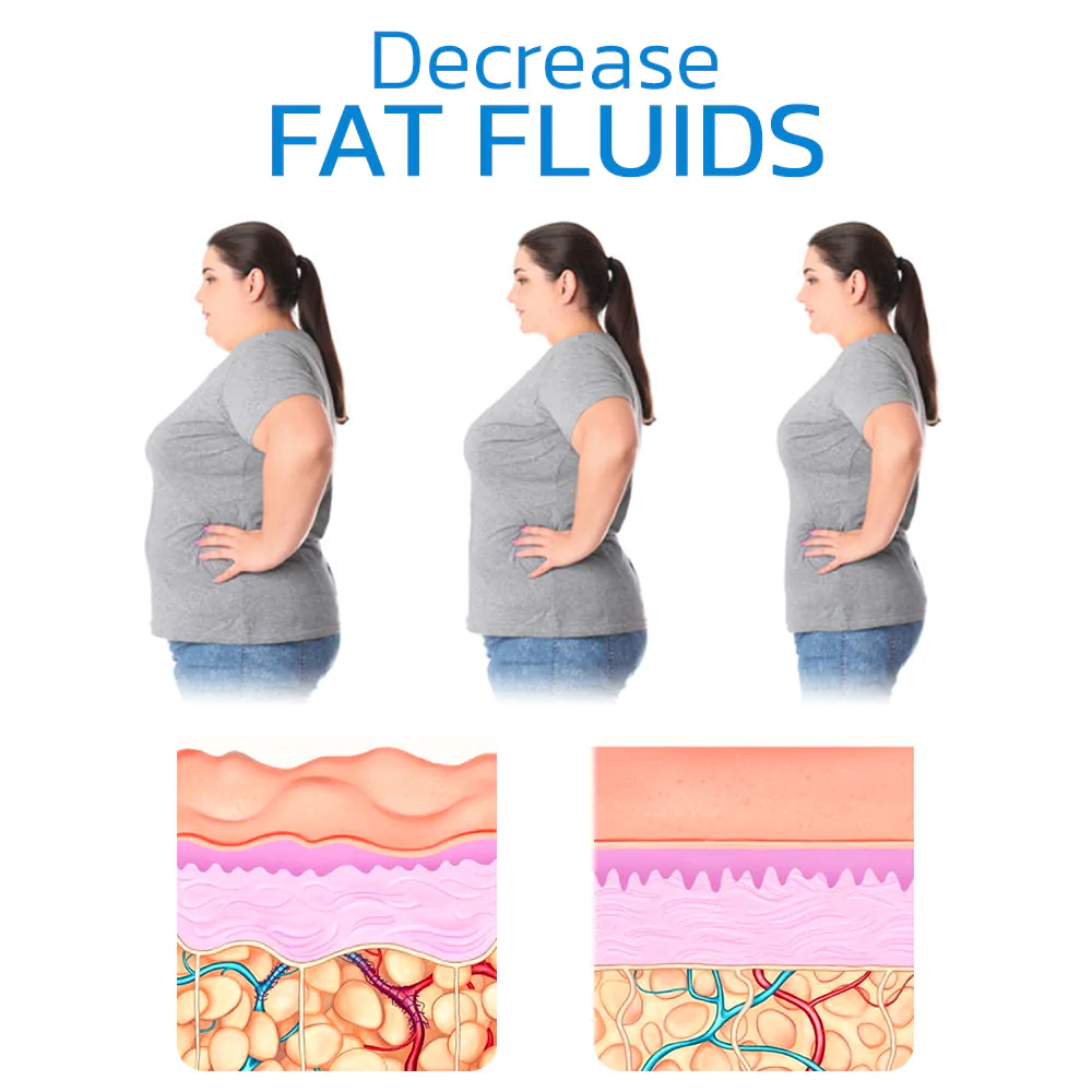 50% RABAT | ChicLift™ - Opstrammende og kropsformende trusser med grafen!